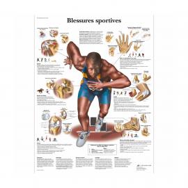 Planche anatomique blessures sportives