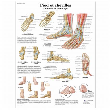 Poster Pied et chevilles - Anatomie et pathologie