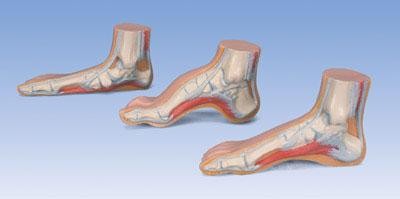 Cure Pied - Equipement Du Cheval - Rouge - Gamm Vert